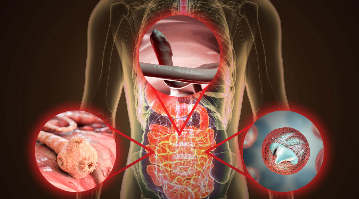 parasites in the gut